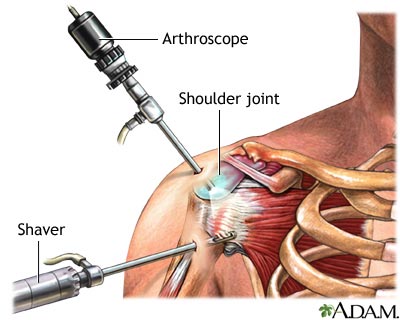 Shoulder Structure